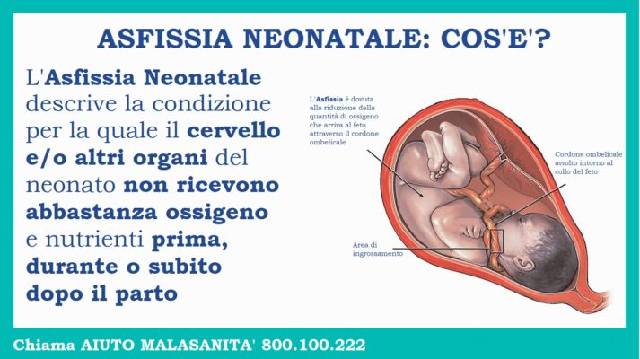 Conseguenze di Asfissia Neonatale